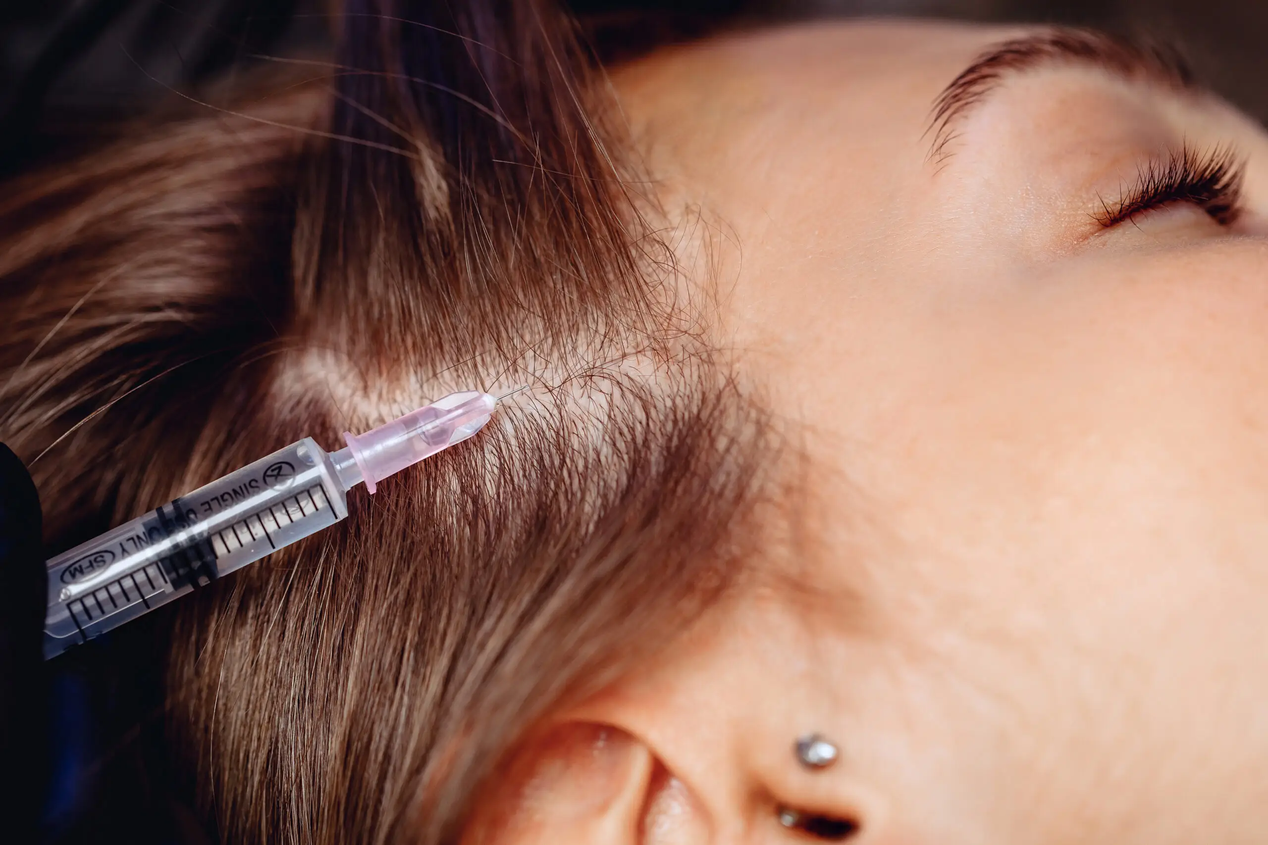 Jak działa peptydowa terapia włosów?