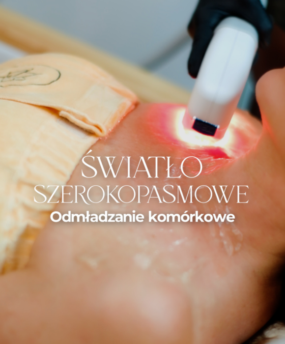 Światło Szerokopasmowe BBL Katowice. Zabieg światła szerokopasmowego w Katowicach w Bellarte - pacjenci wysoko ocenią efekty tego zabiegu w bellarte katowice